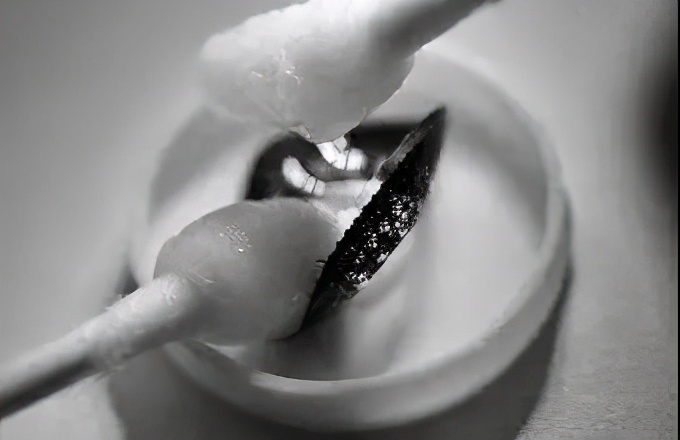 儿童角膜溃疡严重会穿孔吗,儿童角膜溃疡