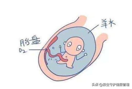 羊水过少危害大？准妈妈们该了解的6个小问题