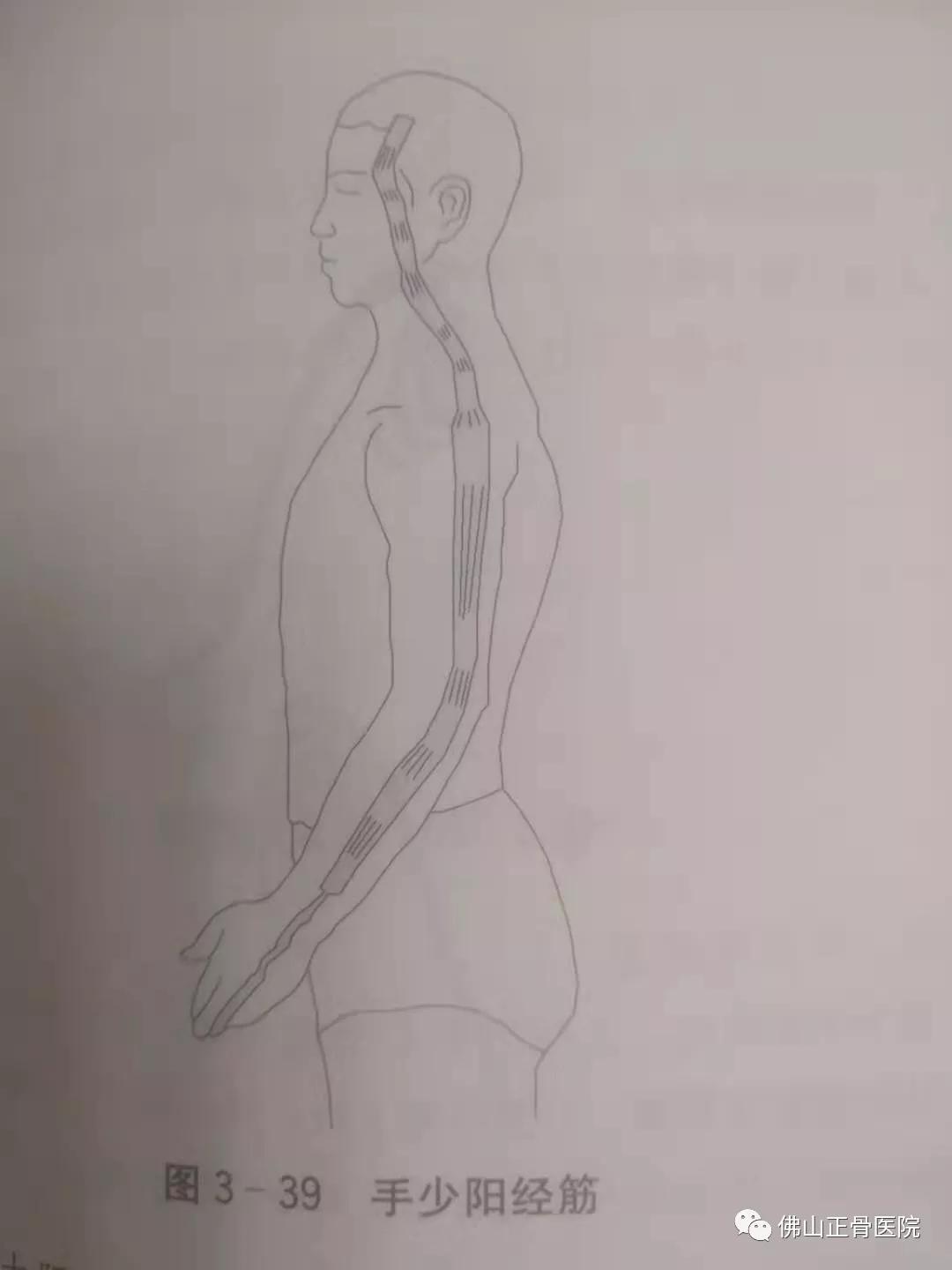 经筋手法，我院名誉院长国医大师韦贵康《韦氏骨伤手法集成》