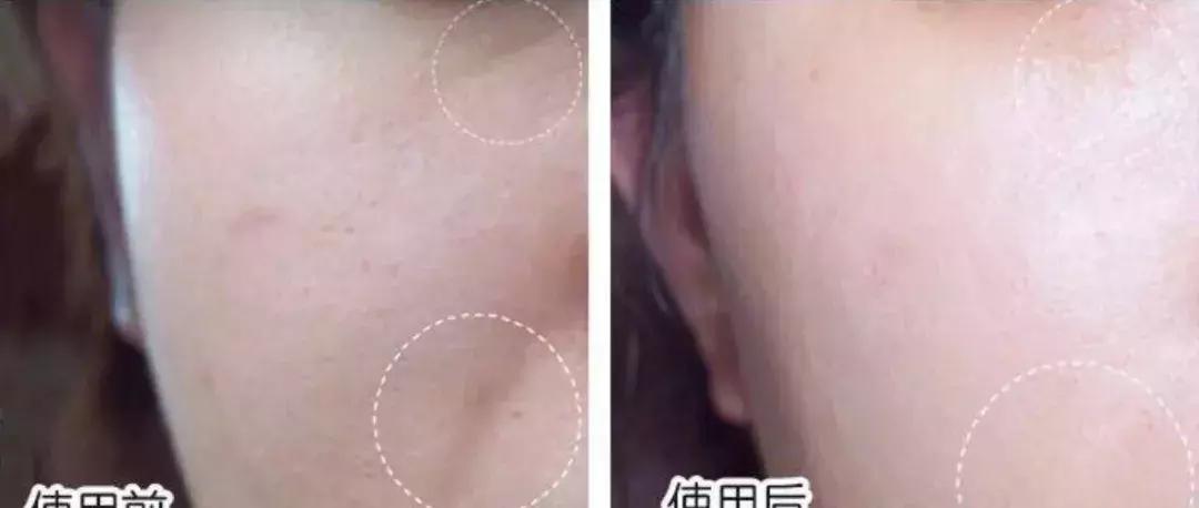 明星童颜秘诀，每1秒卖出10瓶的TA，素人高呼有效淡纹、去暗沉！