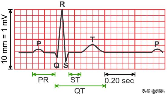 跑步心率监控什么手表好,光电手表心率偏高还是偏低