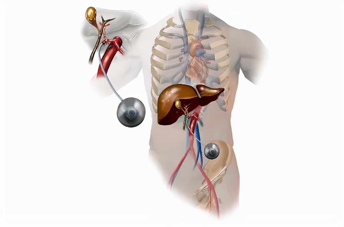 全身化疗能根治癌症吗,全身化疗的副作用有哪些