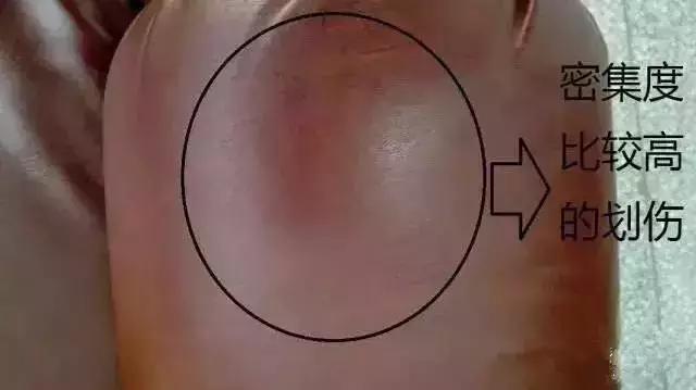 牛皮上有疤痕,做成真皮沙发时怎么补救?