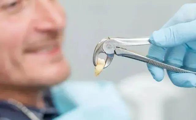 牙齿松动一定需要拔牙吗,牙齿松动还需要补牙吗