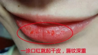 嘴巴干裂起皮推荐护唇油,秋冬季嘴唇干裂起皮这样涂