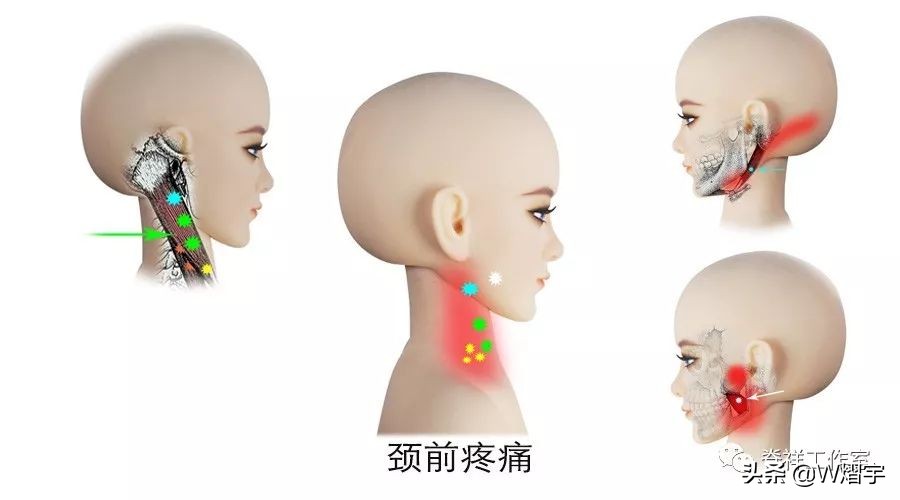 吞咽痛并有痰是什么原因,吞咽时舌下疼怎么办