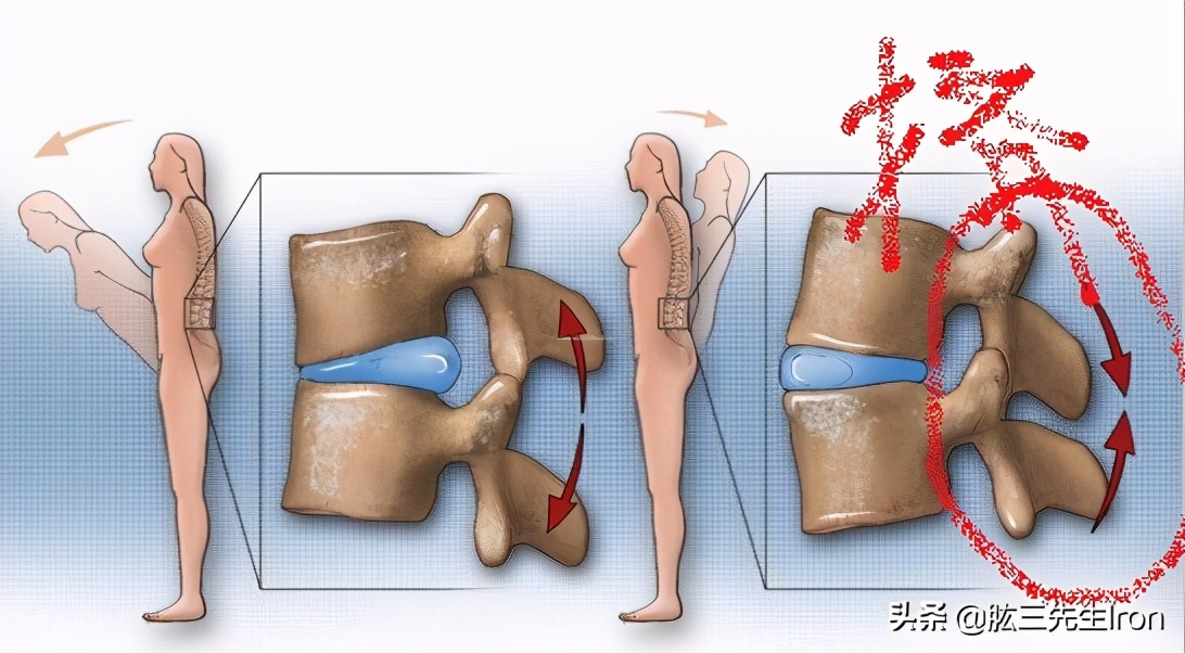 腰部受伤了怎么恢复训练,腰部受伤最佳恢复方法