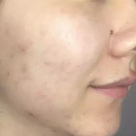 自带磨皮特效粉底液,自带磨皮效果的粉底液