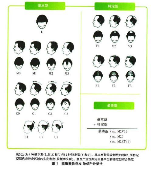 每天掉头发的次数判断脱发程度,怎么预防脱发掉头发