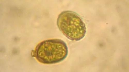 鱼类水产养殖需要哪些藻类,水产养殖显微镜下各种藻类