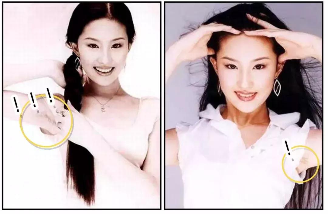 8种脱毛方法了解一下,5种最靠谱的脱毛方法