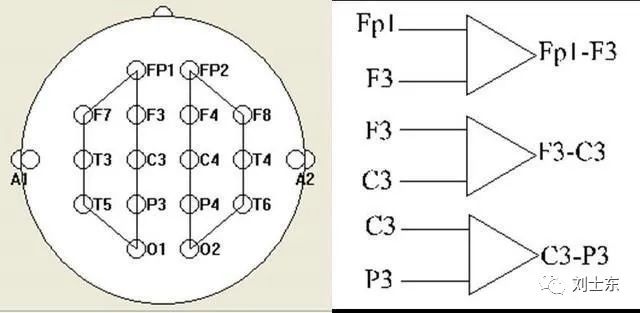 脑电图基础知识入门,脑电图基础知识讲解
