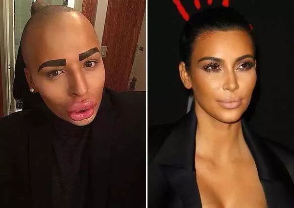 做了微整之后的感悟,微整经验