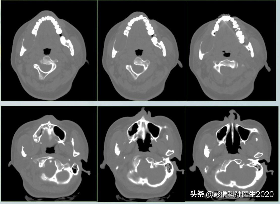 case10什么意思,case案例合集