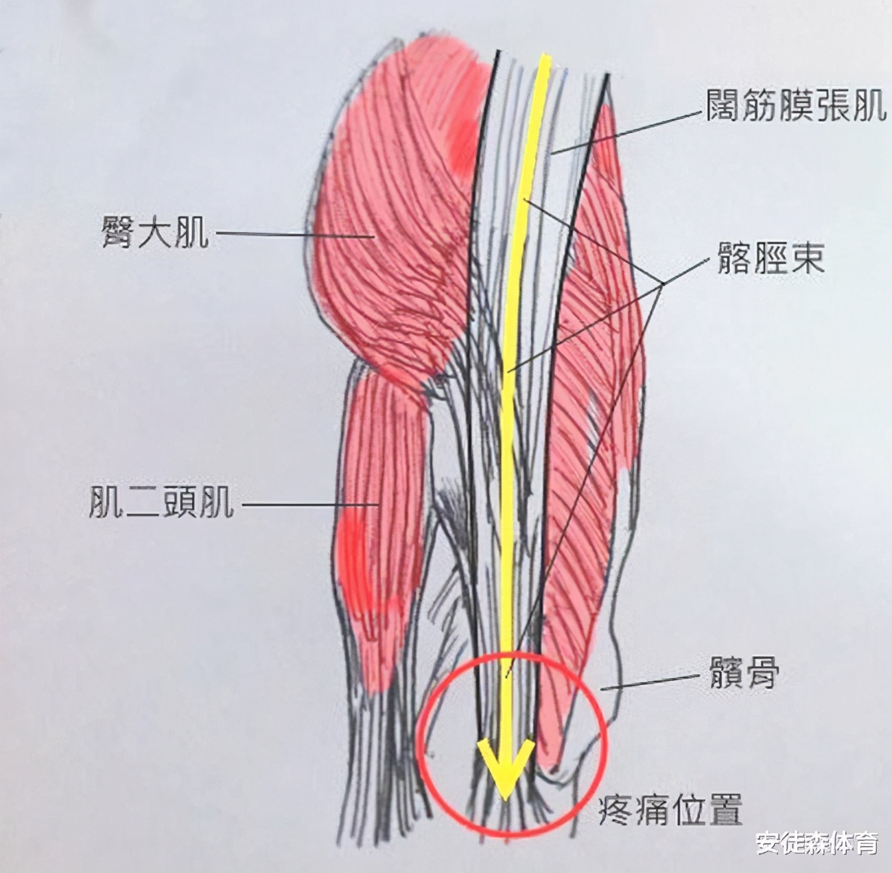 膝盖外侧痛怎么办,膝盖外侧痛贴什么膏药
