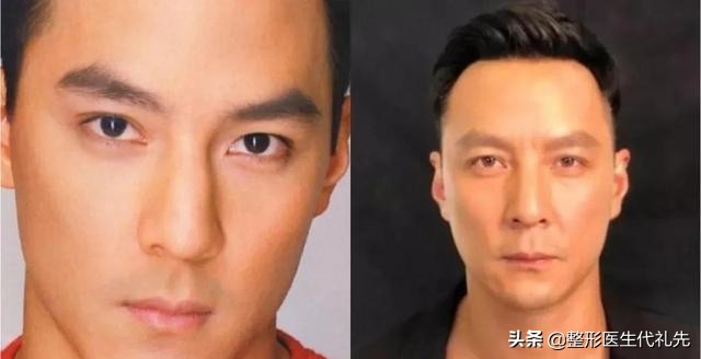 人中长显老怎么化妆改善,人中长显老怎么改善