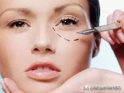 46岁做眼袋还需要做卧蚕吗,现在都把眼袋叫卧蚕了吗