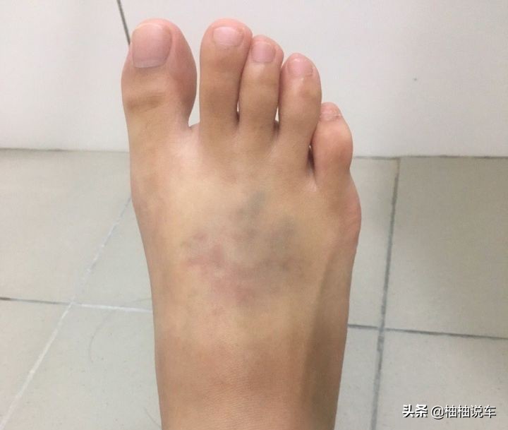 车从脚上压过去有事吗,小车从脚上压过去会怎么样