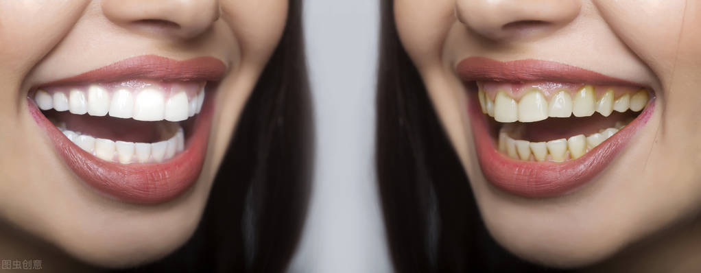 牙齿变黄变黑怎么处理,牙齿变黄变黑的原因及改善方法