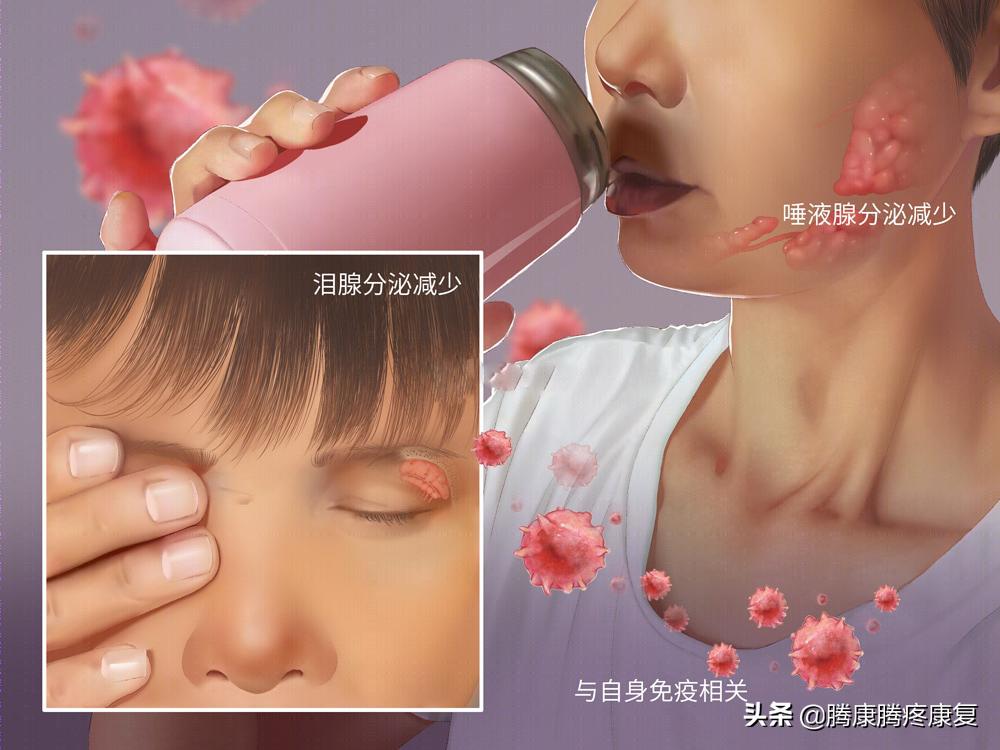 类风湿关节炎病因与发病机制,类风湿关节炎的病因与发病机制