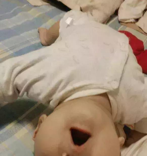 宝宝一直打挺后仰哭闹怎么回事,脑瘫儿站立总是后仰打挺