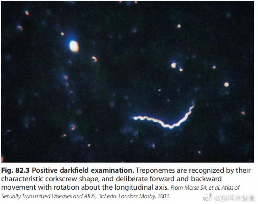 梅毒如果一直不治会怎么样,幼儿梅毒不治会自愈吗