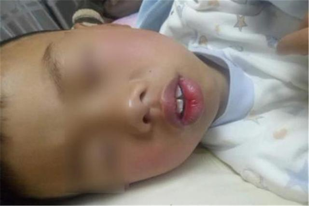 儿子越长越像大猩猩,长得像大猩猩的脸型