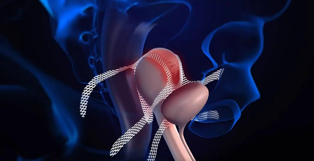 尖端医疗真的救人？数万名女性被害惨背后，让人发寒的纪录片