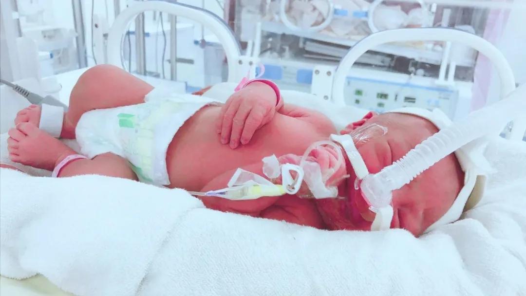 全国知名的新生儿科专家,新生儿权威专家