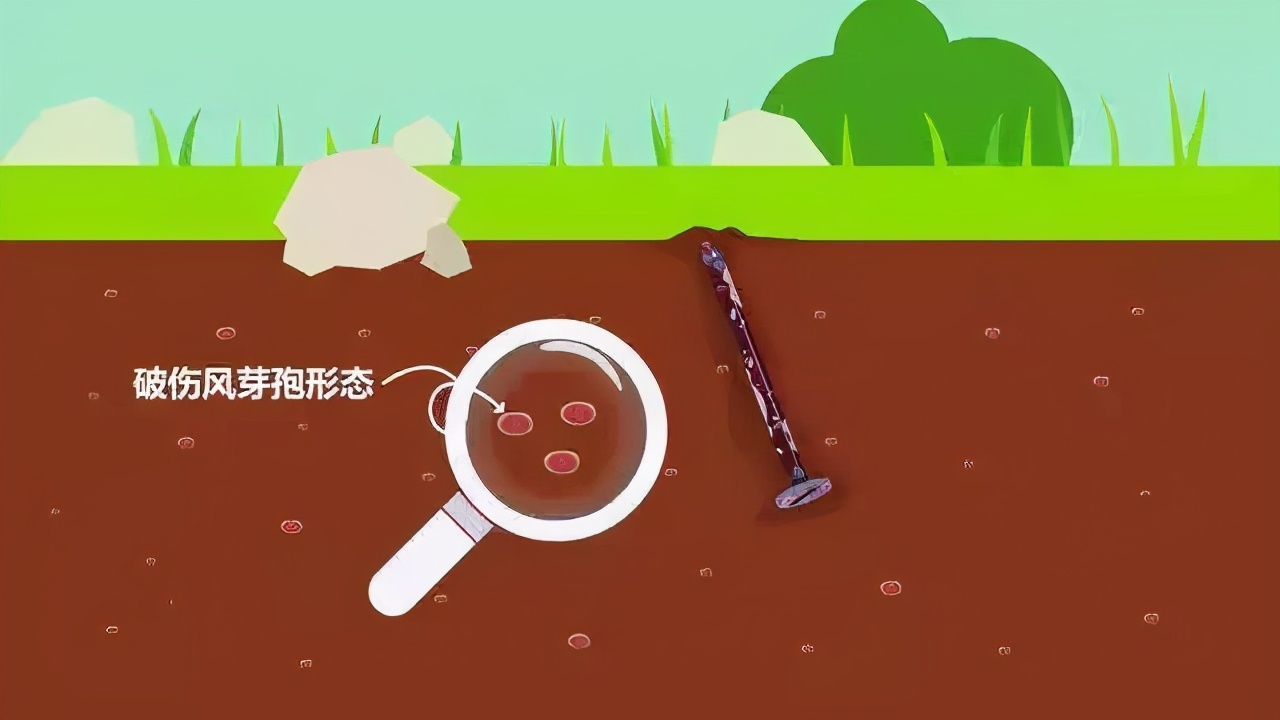 外伤后破伤风针具体指什么,受伤后什么时间注射破伤风针有效