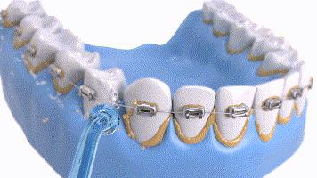 小米生态链新品刮足器,小米生态链工具