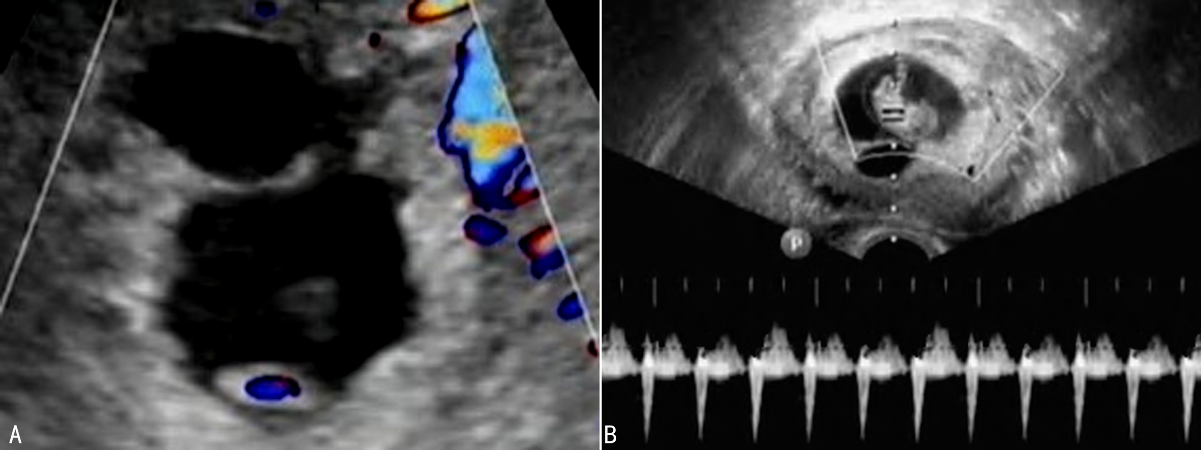 孕检超声检查对照表,明明白白做ct检查