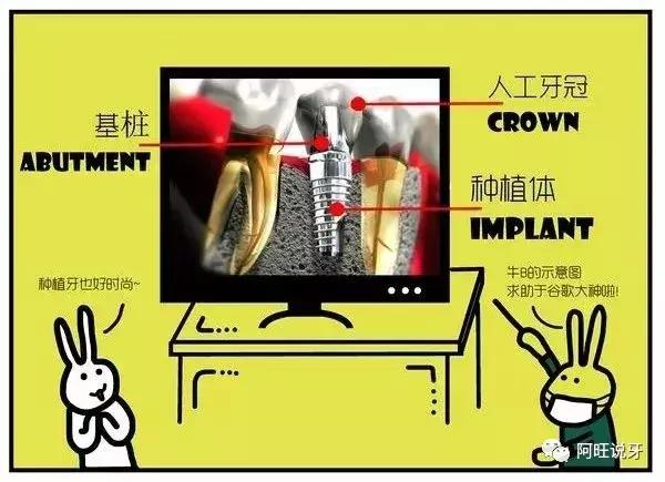 种植牙图片漫画,3d动画2分钟全面了解种植牙全过程