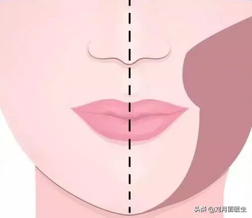 修复苹果肌改善法令纹,改善法令纹的面部运动