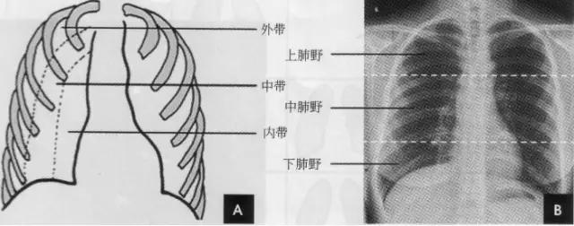 收藏：详细的胸部X线解剖，最基础最实用