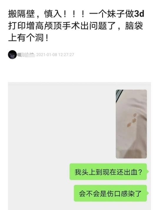 整形小腿肌肉切除,腿部整形手术好吗