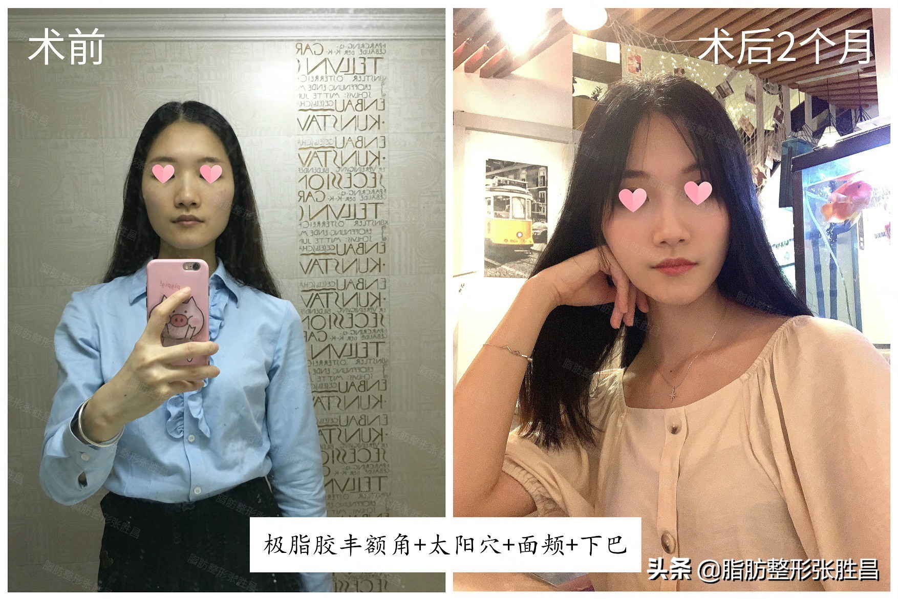 面部特别凹陷的人命运,面部凹陷超显老