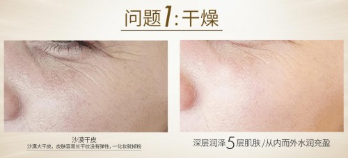 澳洲cemoy面霜真的好用吗,cemoy面霜修红测评