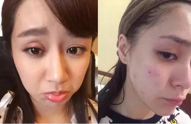 公认最好的物理灭蚊器,世界上最先进的激光灭蚊器