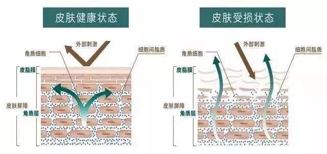 湿疹泛红粗糙干裂，这些宝宝常见的皮肤问题，怎么才能解决？