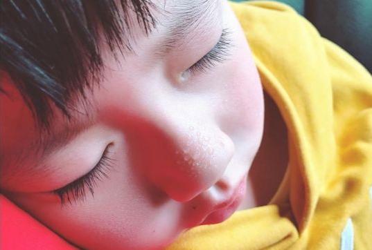 宝宝多汗怎么治,幼儿比一般的孩子多汗正常吗