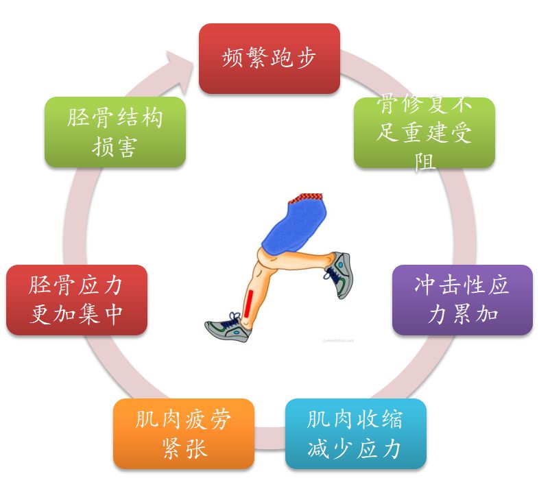 跑者小腿内侧痛,大神级跑者小腿