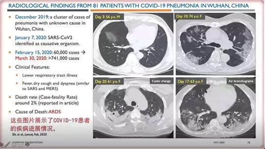 癌症中心SimritParmar教授：脐带血的最新应用