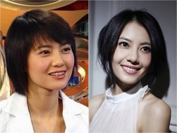 蔡徐坤整牙前图片,蔡徐坤整牙前后照片