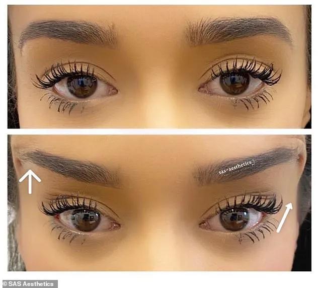 亚洲人“丹凤眼”成西方热门整容项目？一边歧视一边悄悄整容？