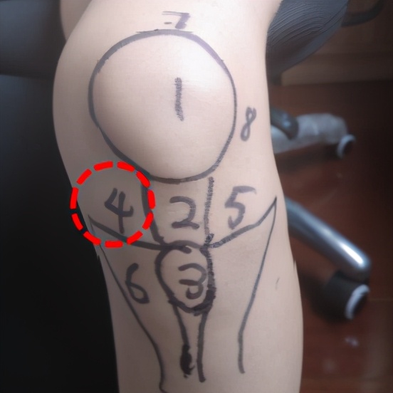 不同部位膝关节,骨科医生教你一招搞定膝盖痛