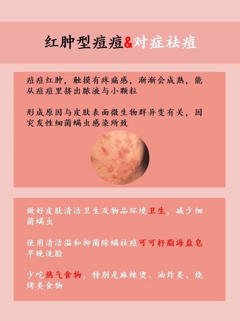 可以针清的痘痘类型,怎么区分各种类型的痘痘