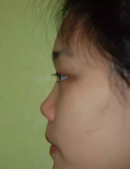 塌鼻好看的明星,哪些明星的鼻子是蒜头鼻和塌鼻子