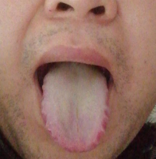 肾虚寒湿证的治法,肾虚湿热症用什么中药调理