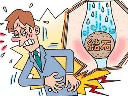 泌尿系统结石肾结石的物理治疗,分享一个治疗结石最好的偏方